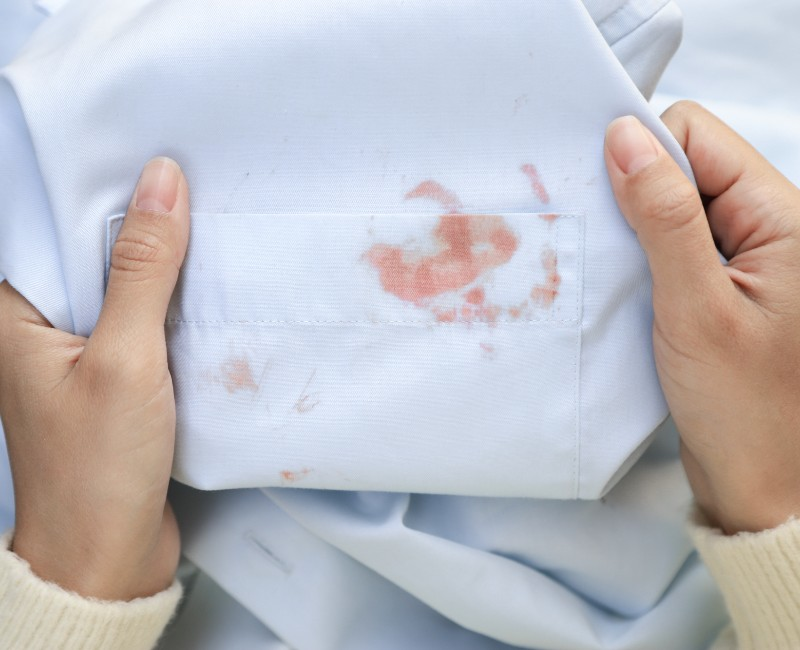 薬剤の付着により変色してしまったお客さまの衣服